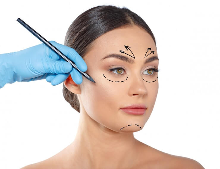 Blefaroplastia en Monterrey